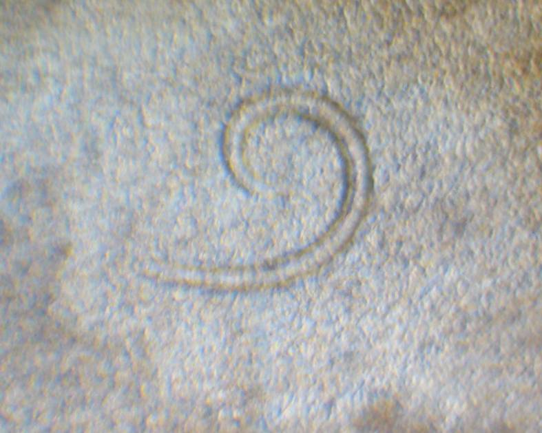 Protostrongylidae larvae from mollusks of Armenia (b)